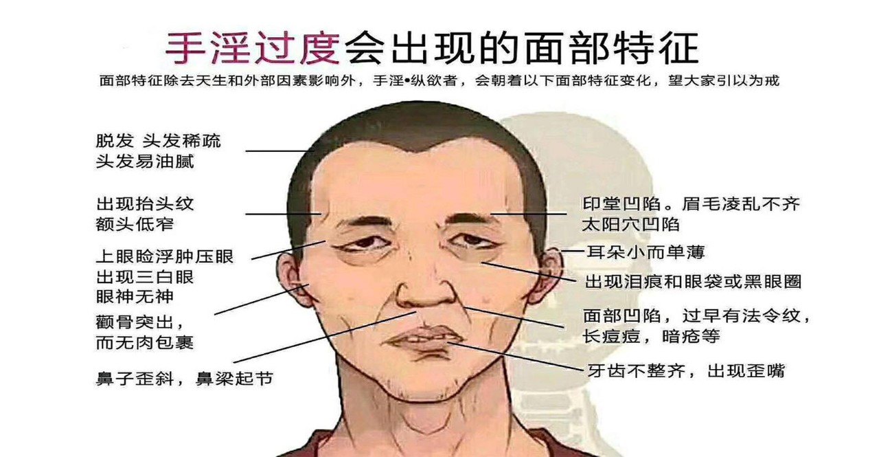 戒 手淫